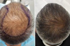 Before-after-2
