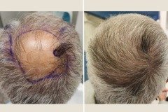 Before-after-3