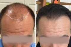 before-after-10