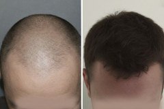 before-after-16