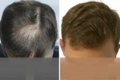 before-after-17