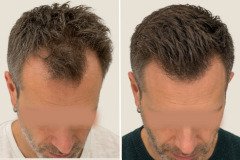 before-after-21