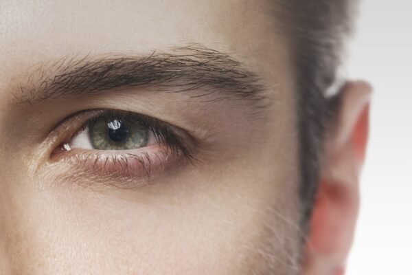 Μεταμόσχευση φρυδιών σε άνδρα στην Clinique de Monsieur για φυσικό και πυκνό αποτέλεσμα.