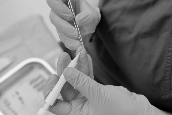 Οδηγός μεταμόσχευσης μαλλιών για άνδρες με πληροφορίες για τη διαδικασία και τα αποτελέσματα στην Clinique de Monsieur.