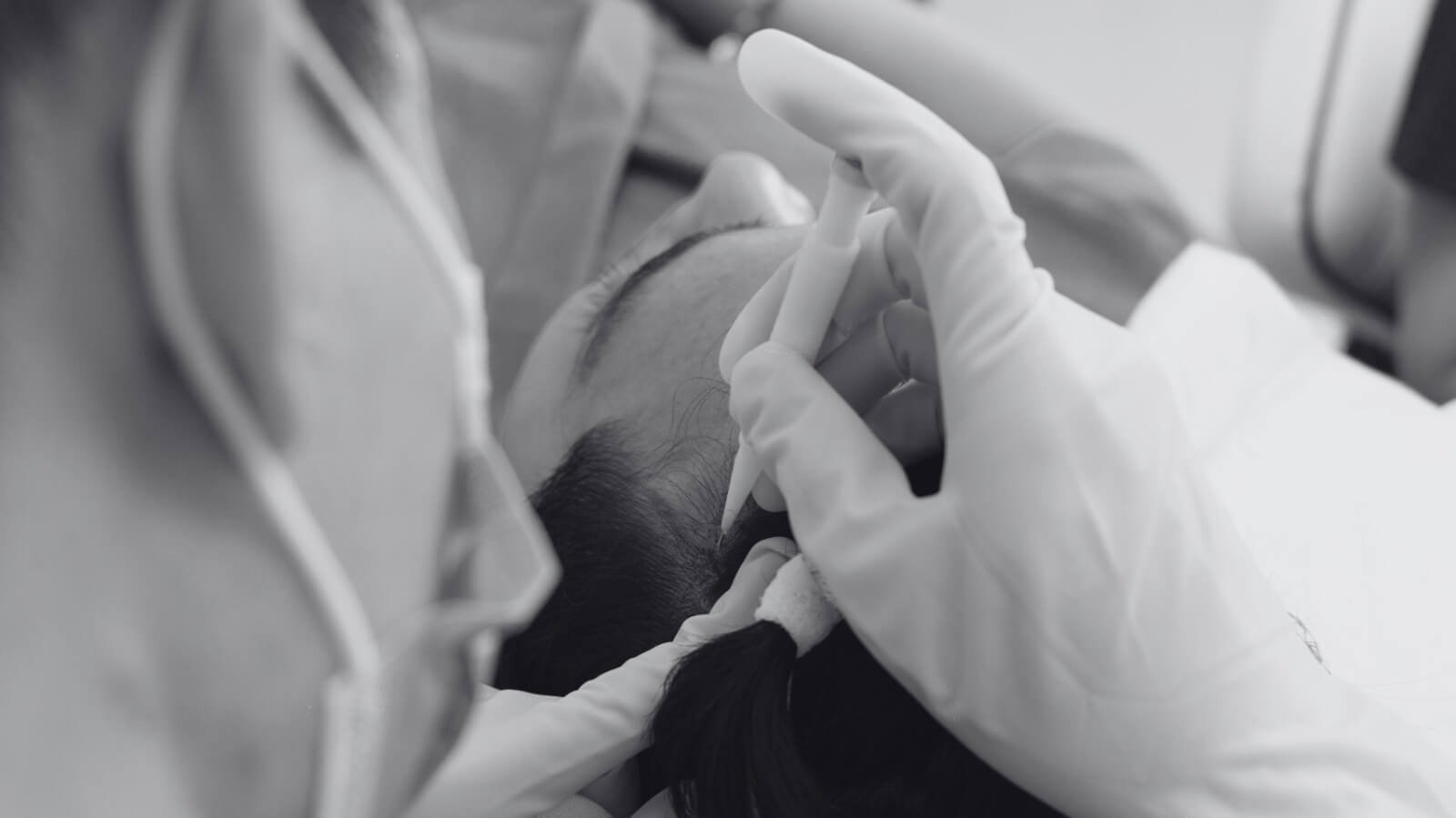 hair-transplant-cost-2