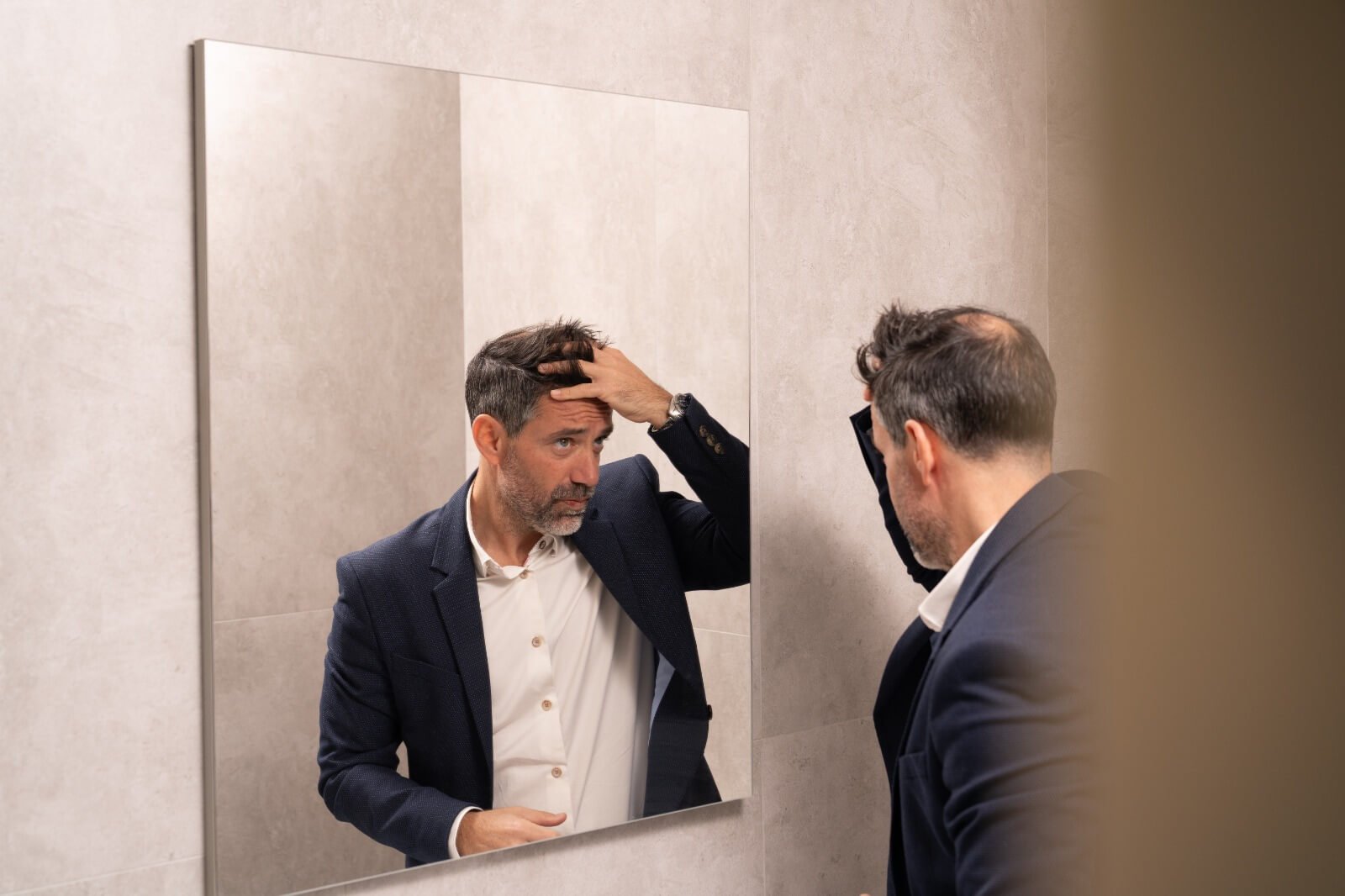 Μεταμόσχευση μαλλιών για άνδρες στην Clinique de Monsieur με στόχο φυσική πυκνότητα και βελτίωση της hairline.