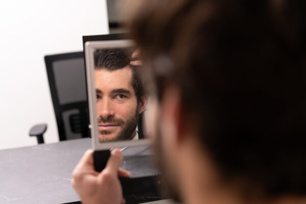Natural hairline after Direct FUE hair transplantation in a man