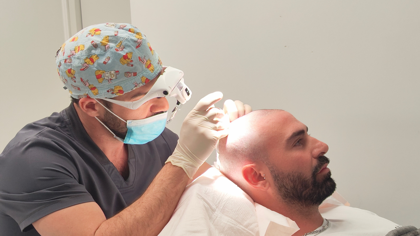 Direct FUE Hair Transplant Procedure at Clinique de Monsieur