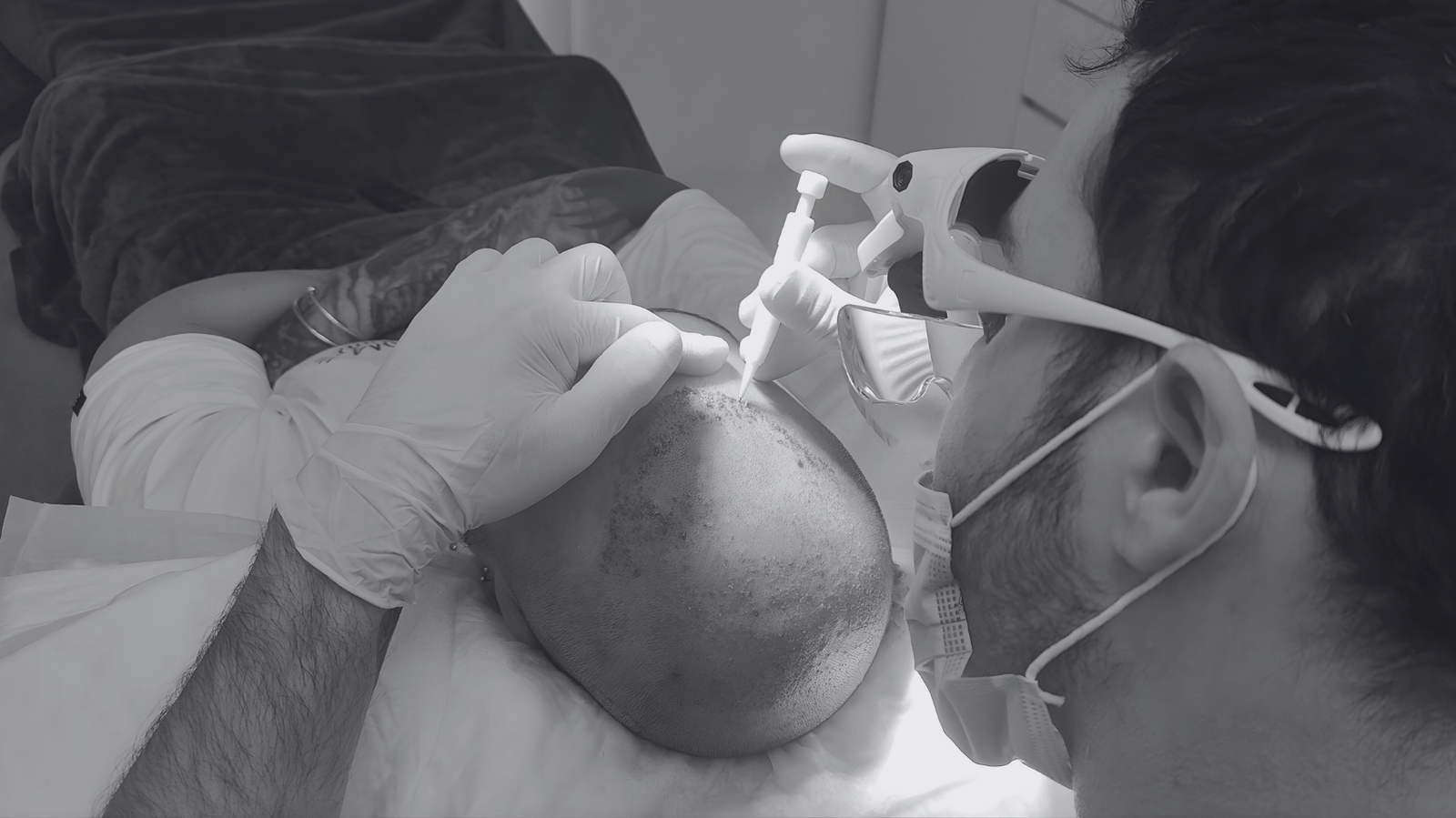 Medical extraction and implantation of grafts with precision during hair transplantation