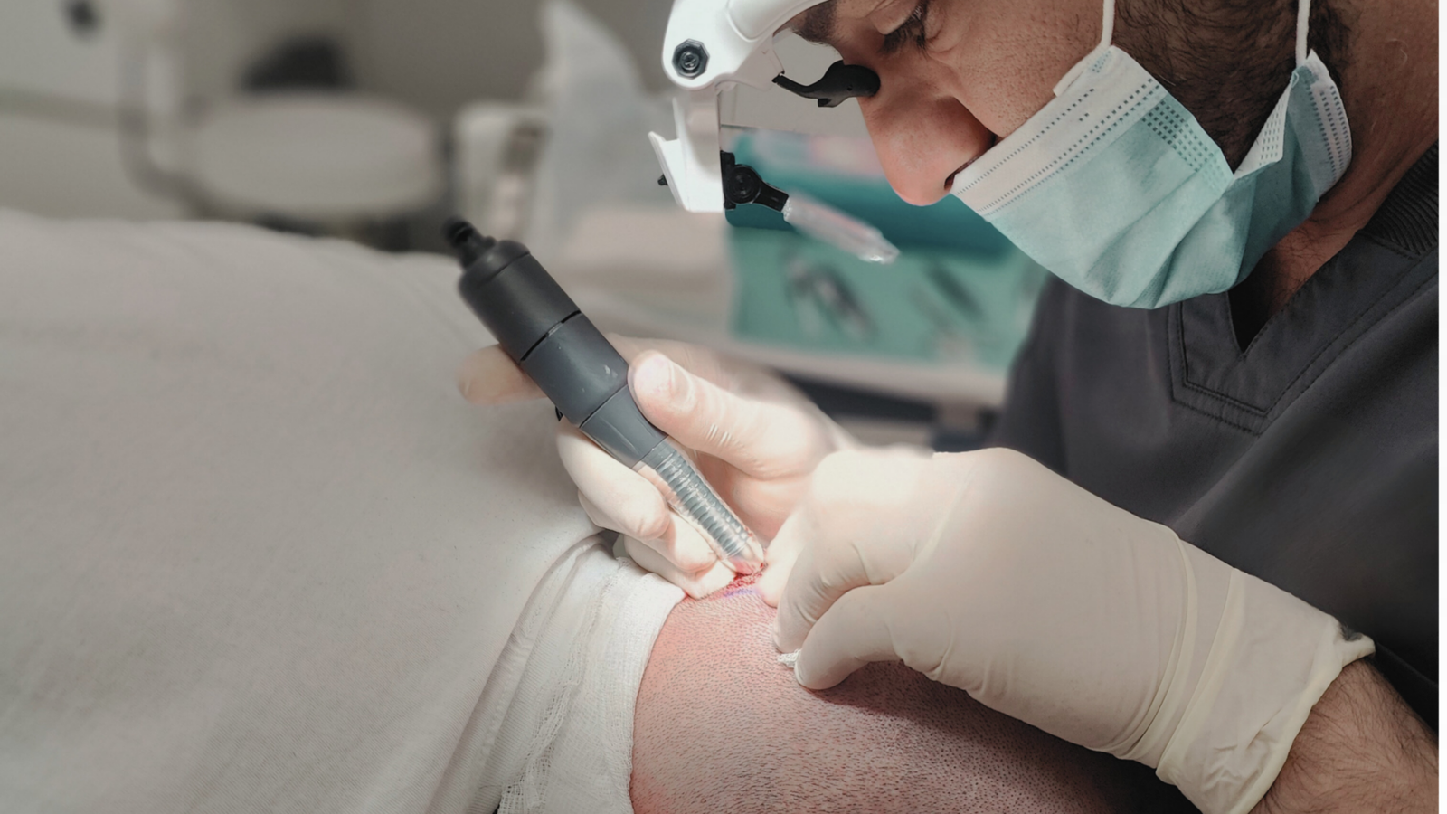 Close-up of a specialist performing a Direct FUE hair transplant with a precision implantation device on the frontal hairline.