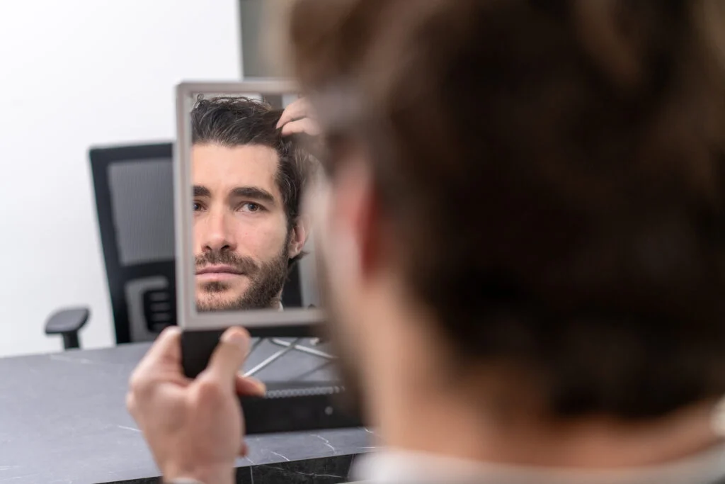 Άνδρας ελέγχει τα μαλλιά του στον καθρέφτη πριν από μεταμόσχευση μαλλιών πριν τον γάμο