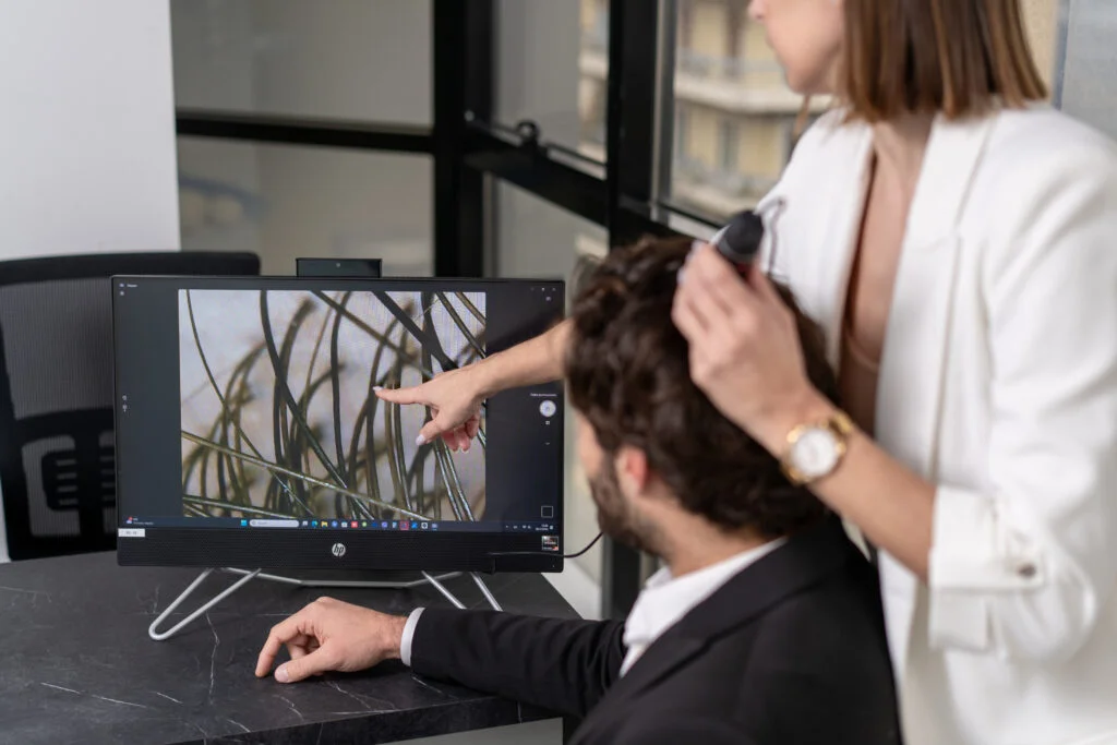 Γιατρός εξετάζει το τριχωτό στην οθόνη για σωστή διάγνωση πριν από μεταμόσχευση μαλλιών