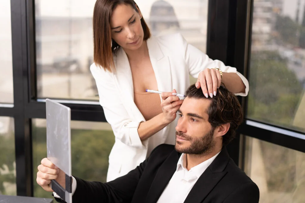 διάγνωση μεταμόσχευσης μαλλιών, αριθμός μοσχευμάτων, πλήθος μοσχευμάτων, δότρια περιοχή, δότρια ζώνη, υπερεξαγωγή, σχεδιασμός γραμμής μαλλιών, στρατηγική πυκνότητας, διάχυτη αραίωση, ανδρικού τύπου φαλάκρα, ανδρογενετική αλωπεκία, σχεδιασμός μεταμόσχευσης μαλλιών, Direct FUE, Clinique de Monsieur, αποτελέσματα μεταμόσχευσης μαλλιών, αποκατάσταση μαλλιών