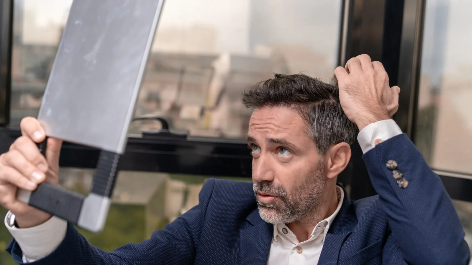 Άνδρας ελέγχει την αραίωση των μαλλιών του για τη σωστή ηλικία για μεταμόσχευση μαλλιών