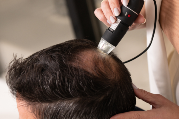 Crown trichoscopy analysis for hair loss diagnosis in male patient