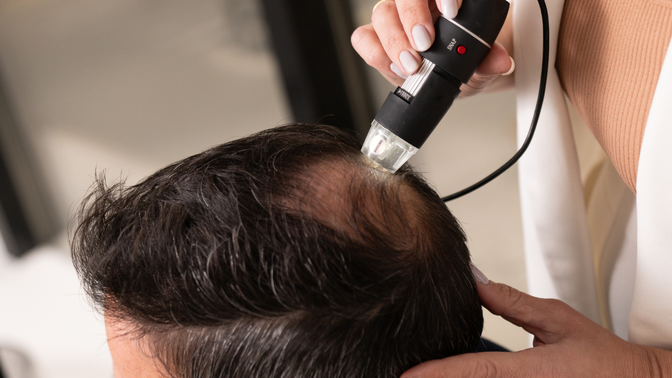 Crown trichoscopy analysis for hair loss diagnosis in male patient