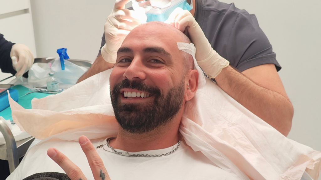Patient smiling during a hair transplant procedure at the clinic