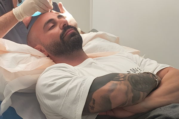 Patient lying comfortably during a hair transplant procedure at the clinic