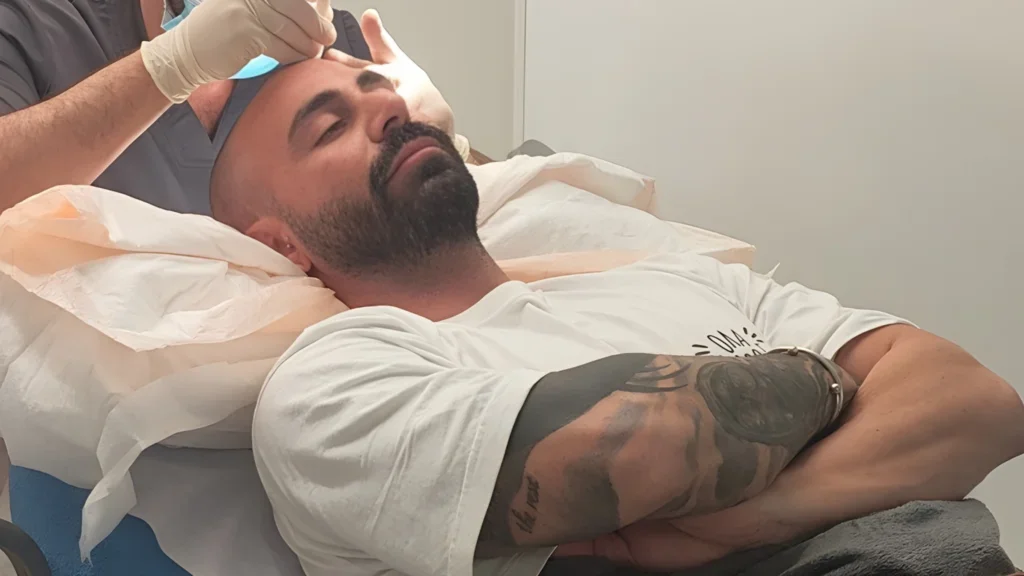 Hair transplant procedure being performed on patient in clinical setting