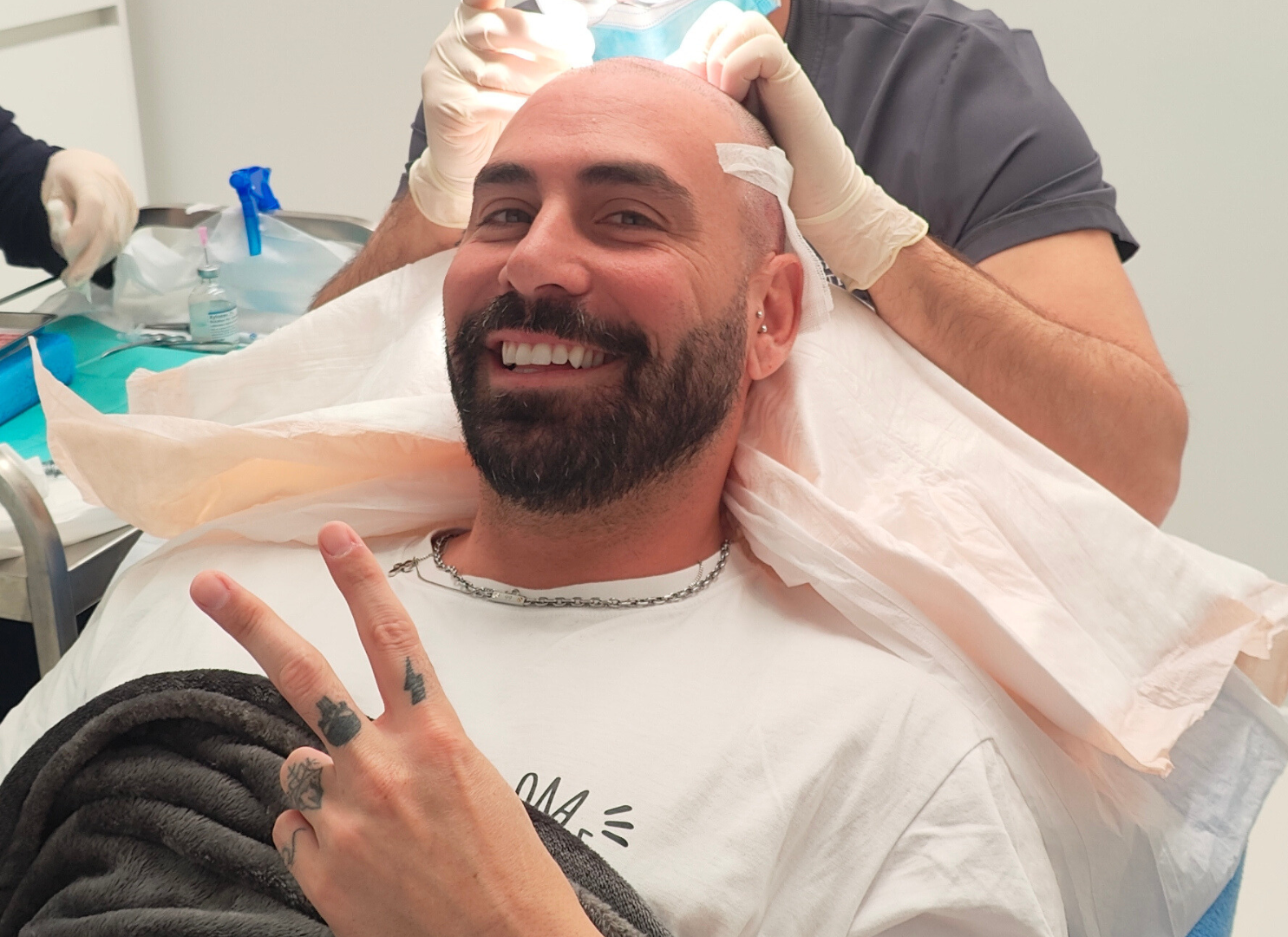 Graft survival hair transplant procedure using Direct FUE during implantation