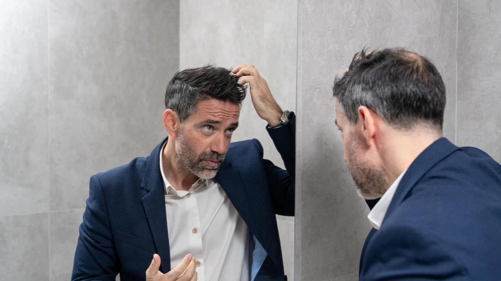 Άνδρας με αραίωση μαλλιών εξετάζει τη γραμμή των μαλλιών του στον καθρέφτη