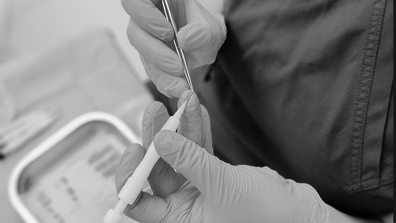 Graft preparation with Choi implanter for hair transplant